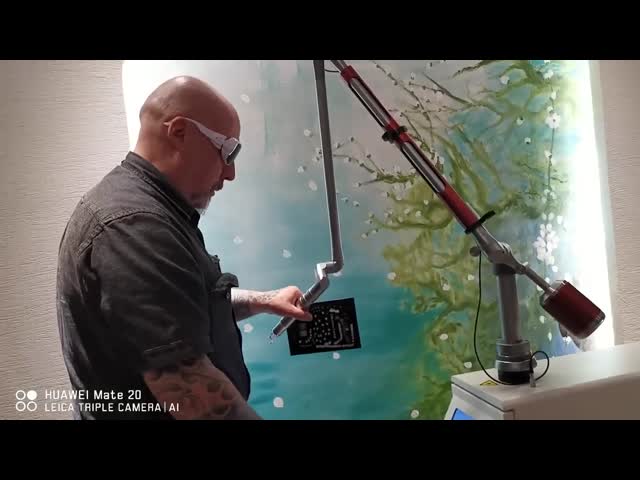 Q Switch ND YAG удаление пятен удаление пигмента удаление пикосекундных лазерных татуировок 532/755/1064nm видео