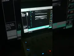 машина Допплер цвета блока развертки ультразвука монитора СИД 12,1 дюймов портативная с портом УСБ 2 video