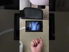 Высокий тип прибор таблицы разрешения 800С480 локатора вены с экраном 3.5Инч для ноги руки руки video