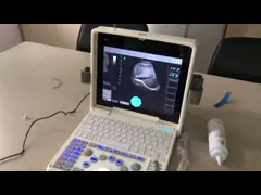 Блока развертки ультразвука B/W тетрадь преобразования частоты 3000J портативного БИО video