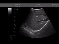 Блок развертки ультразвука цифров зонда ультразвука УСБ портативный с зондом частоты 2~15МХз video