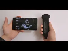 блок развертки ультразвука Допплер цвета 2 -11МХз ручной любит мобильный телефон video