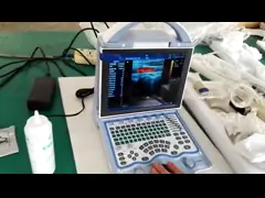 China Mini Pocket Handheld Ultrasound Scanner Color Doppler Probe Changeable with Frequency of 2~11MHz supplier