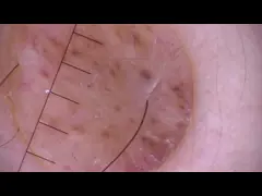 Lcd контролирует офтальмоскоп Otoscope цифров видео- для клинического осмотра человеческого тела video