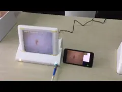 Влага кожи Хандхлед цифров и анализатор масла с профессиональным анализом программного обеспечения video