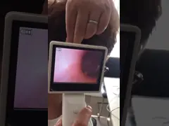 Набор Отоскопе цифров видео- для зараженных диагностики уха и прокалывания барабанчика уха video