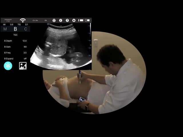 Transvaginal調査色のドップラー超音波の走査器、ドップラー手持ち型の妊娠