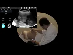 Блок развертки ультразвука выпуклого линейного зонда Допплер цвета Хандхэльд с глубиной 310мм сканирования video