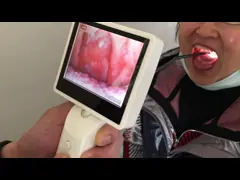 Отоскопе 3,5 цифров Хандхэльд ЭНТ объема экрана дюйма видео- с выведенной наружу УСБ опционной функцией ВИФИ video