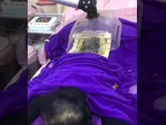 Коррозионностойкий сваривая экстрактор перегара лазера для терапии Moxibustion video
