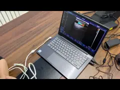Зонд ультразвука USB машины ультразвука руки глубины Wifi 20-305mm video