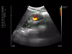 Цвет Doppler мини Handheld блока развертки ультразвука портативный с многочастотными элементами 2-10MHz 128 64 канала video