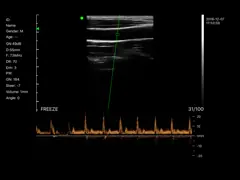 Зонда ультразвука зонда ультразвука кармана элементы 2.4G Wifi веса 235g 128 ультразвука беспроводного Handheld мини только video