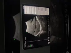 Блок развертки ультразвука клинического диагноза черно-белый Handheld поддерживает вес 235g Windows андроида IOS только video