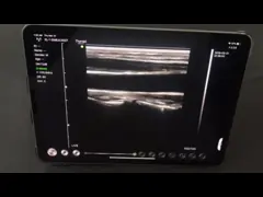 Отчеты о печатания поддержки соединения Wifi блока развертки ультразвука ультразвукового зонда датчика линейного выпуклого Handheld video