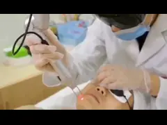 OEM машины 2000mj пикосекунды удаления татуировки лазера Nd Yag video