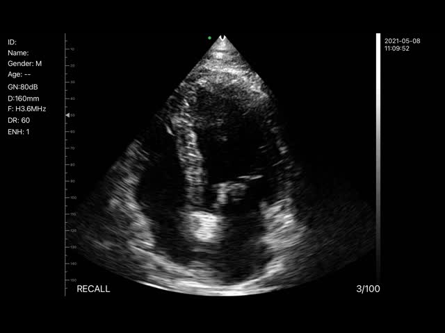 3.6MHz Color Doppler Android Ultrasound Scanner 128 Element