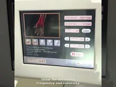 Машина ударной волны спасения 230w ушиба ODM портативная video