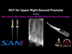 SANI εσωτερική σωματική κίνηση