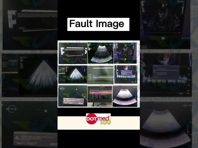 HD11超音波イメージ投射装置修理453561197144