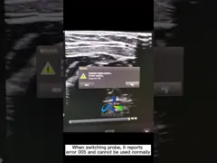 Обслуживание машины эхографии Affiniti 50 ремонта зонда ультразвука детектора Рэй video