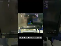 Шарик следа GE Voluson S10 BT18 запасных частей ультразвука здравоохранения S9554921 video