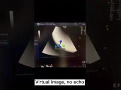 Система ультразвука Logiq S7 медицинская отображая разбивочный объект video