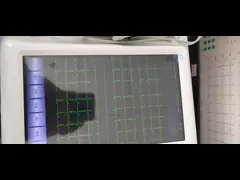 передача данных машины Ecg экрана касания 14.8V медицинская ПК программного обеспечения video