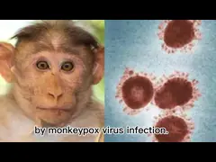 Набор обнаружения вируса Monkeypox набора PCR Monkeypox набора обнаружения Monkeypox быстрый video