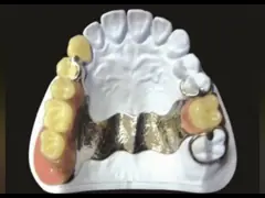 Strong Precision Attachment Denture Firm Denture Customized FDA