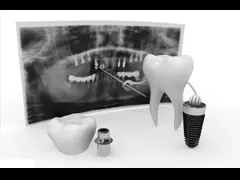 Safe Reliable Artificial Root Implant Long Service Life Natural Dental Implant Bar