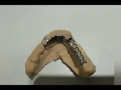 Removable Orthodontic Invisible Retainer Easy Maintenance Beautiful Transparent Color