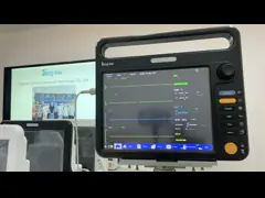 Portable patient monitor multi parameter patient monitor ICU cardiac monitor