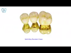 Высокая отливка моста PFM кроны стабильности Semi драгоценная зубоврачебная легкая video