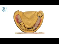 Ultra Hard Removable Invisible Orthodontic Appliances Easy Maintain