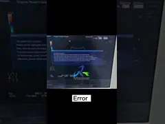 Ремонт машины ультразвука ошибки отчете о Aloka Hivision Ascendus заменяет доску клетки video