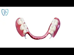 Removable Dental Partial Denture Natural Color 3D Dental Model Customized