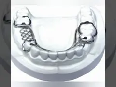 Подгонянные резиновые фиксированные ортодонтические приборы легкие поддерживают video