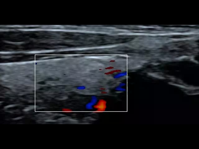 Electronic Convex Array Color Doppler Handheld Ultrasound Scanner 3.5MHz