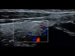 Блок развертки 3.5MHz ультразвука Doppler электронного выпуклого цвета массива Handheld video