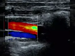 Блок развертки ультразвука кабельного соединения USB 128 элементов мобильный Handheld для ноутбука video
