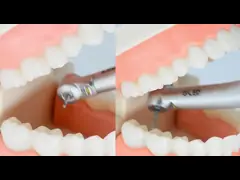 Подшипник небольшого мини блока СИД зубоврачебного Handpiece головы керамический с пневматической турбиной video