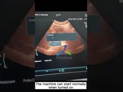 Ремонт оборудования ультразвука доски TX для системы ультразвука Arietta 60 video