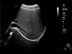 Блок развертки здоровья портативного зонда медицинской службы ISO13485 выпуклого Handheld video