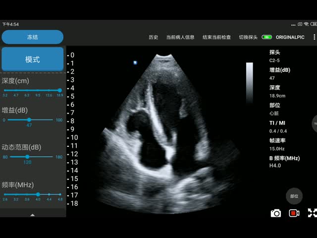 3.6MHz Cardiac Wireless Ultrasound Transducer For Emergency