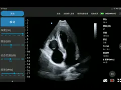 портативный беспроводной фазированный зонд ультразвука 3.6MHz - датчик массива video