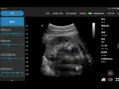 Блок развертки Doppler ультразвука выходного видеосигнала 3.6MHz HDMI диагностический для POCUS video