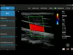 блок развертки ультразвука Doppler цвета 12.6cm портативный для профессионалов здравоохранения video