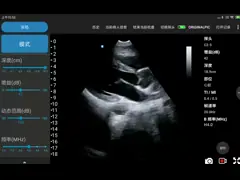Блок развертки ультразвука глубины 18.9cm Handheld для Iphone 3.6MHz video