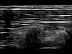 Блок развертки мобильное 8.3MHz ультразвука диагноза и обработки CE домашний video